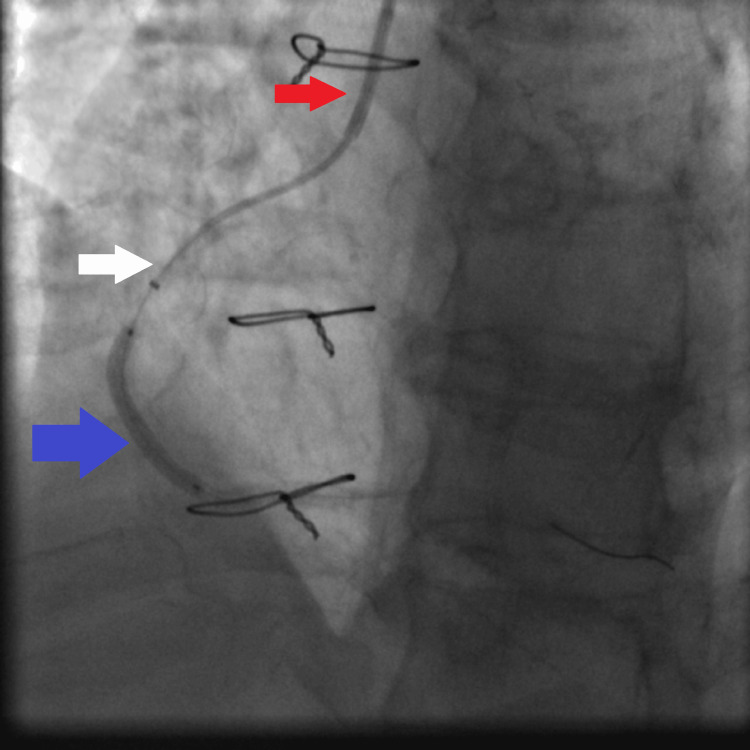 Figure 10