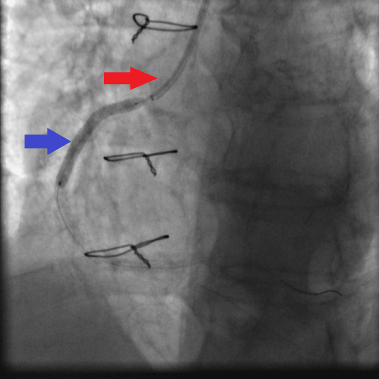 Figure 11