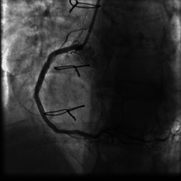 Figure 12