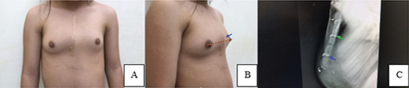 Fig. 4
