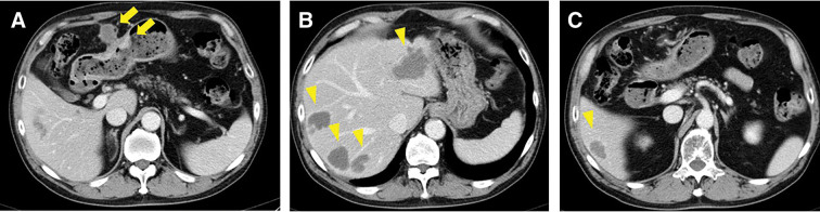 Fig. 3