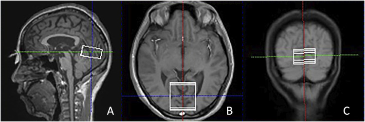 FIGURE 1