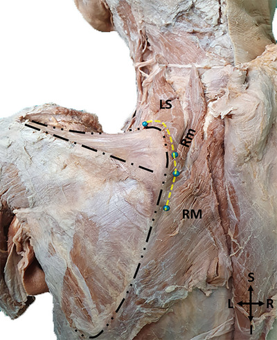 FIGURE 3