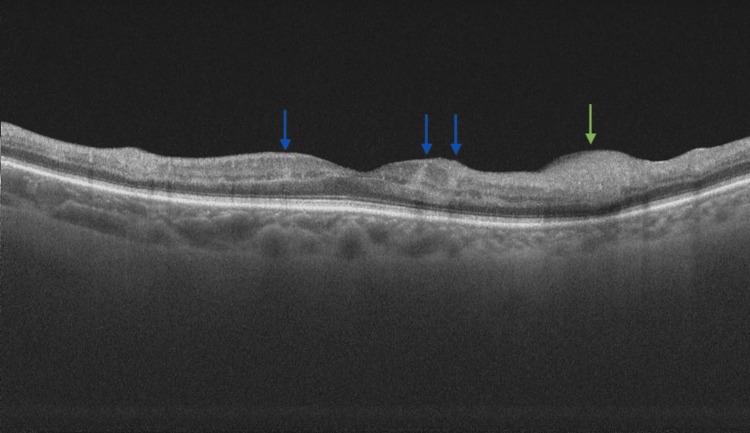 Figure 6