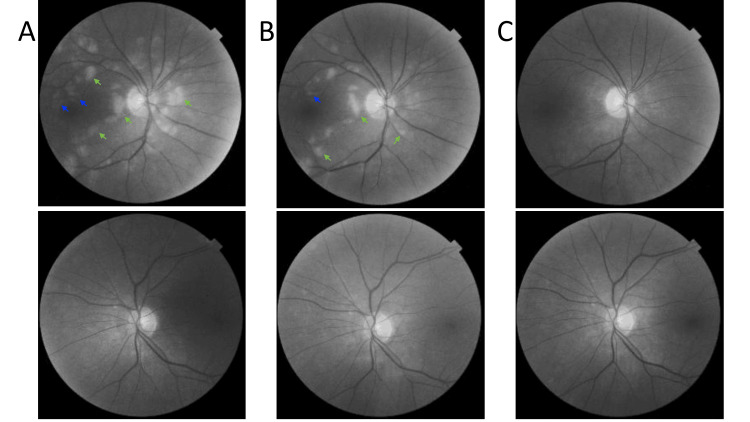 Figure 11
