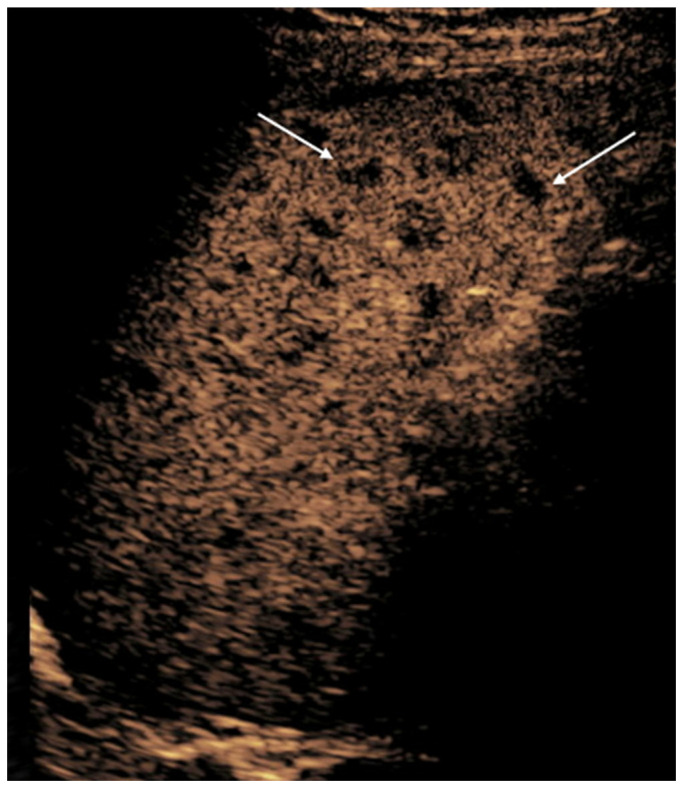 Figure 9