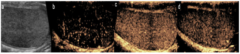 Figure 10