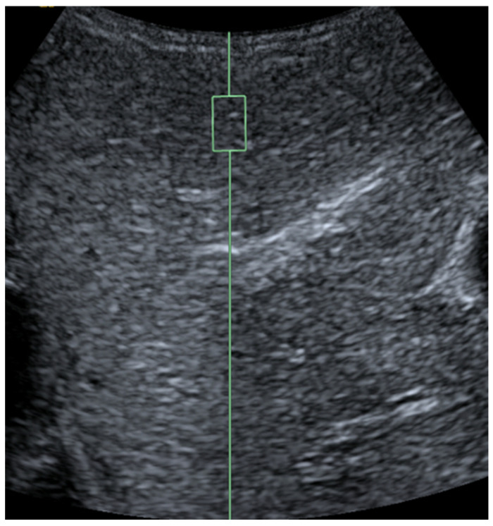 Figure 11