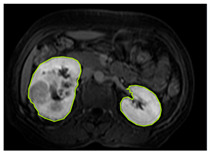 Figure 12