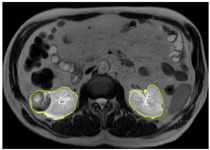 Figure 14