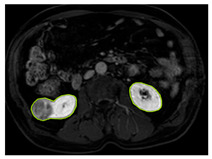 Figure 15