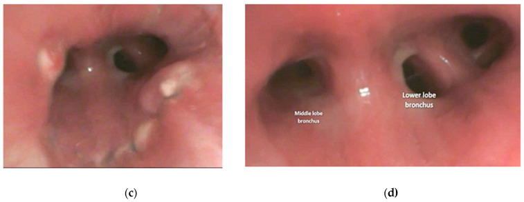 Figure 17