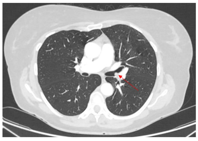 Figure 18