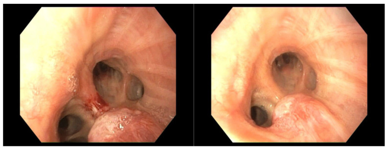 Figure 20