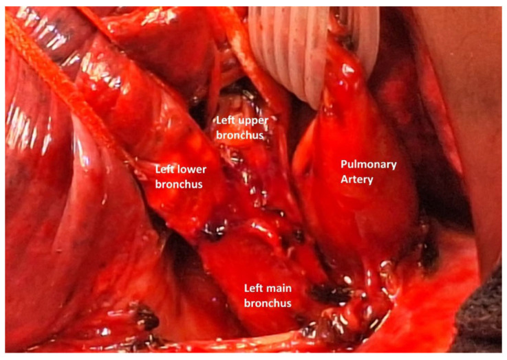 Figure 21