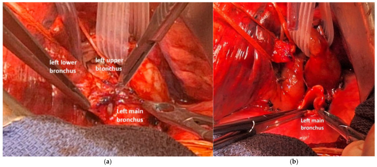 Figure 22