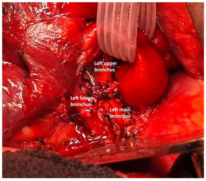 Figure 24