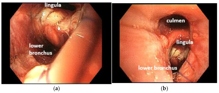 Figure 25
