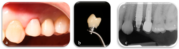 Figure 10