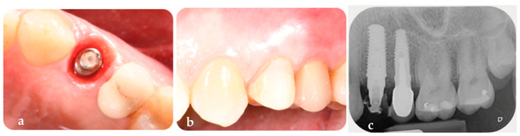 Figure 11