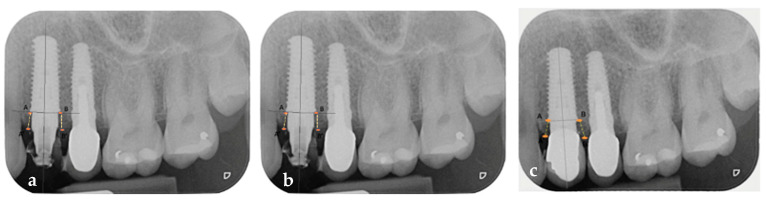 Figure 13