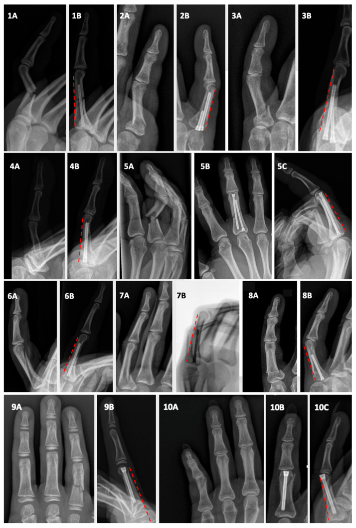 Figure 4