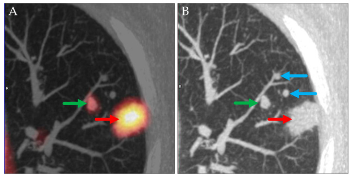 Figure 9