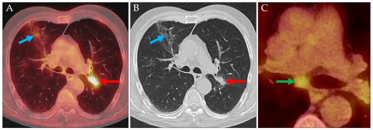 Figure 11