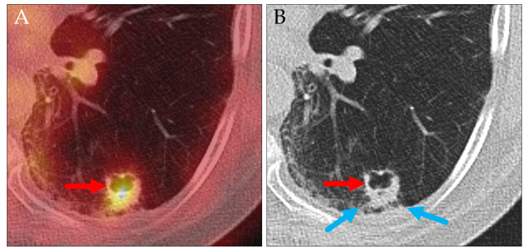 Figure 12