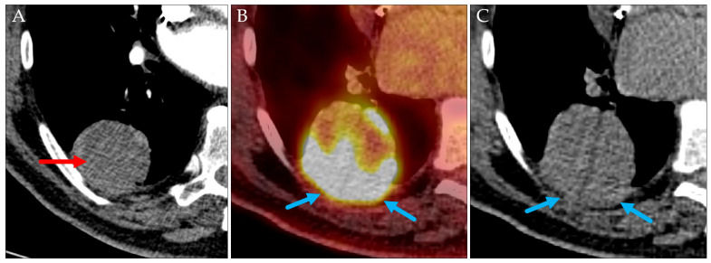 Figure 13
