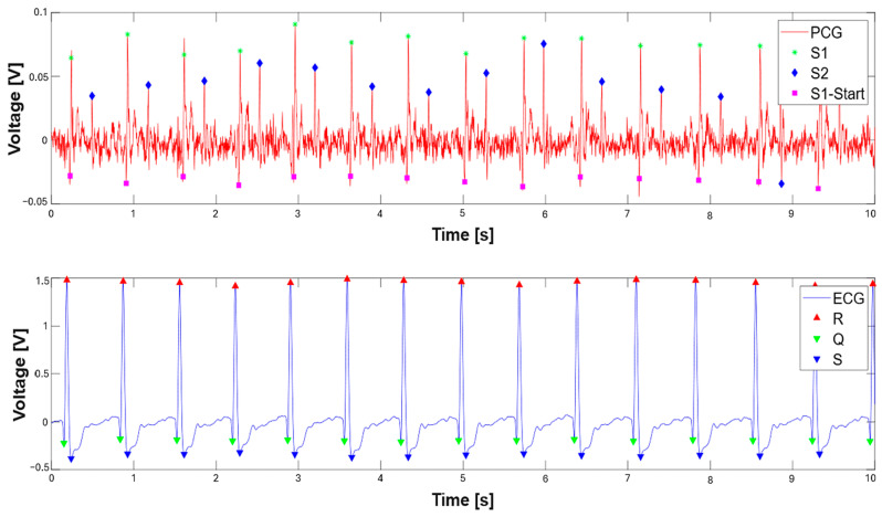 Figure 12
