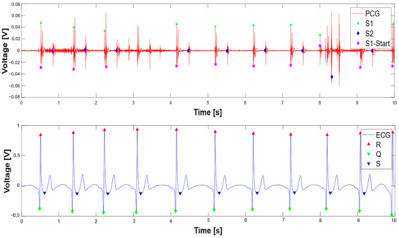 Figure 16