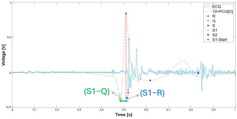 Figure 17