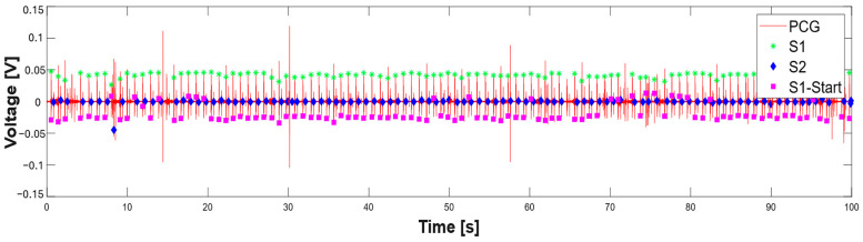 Figure 18