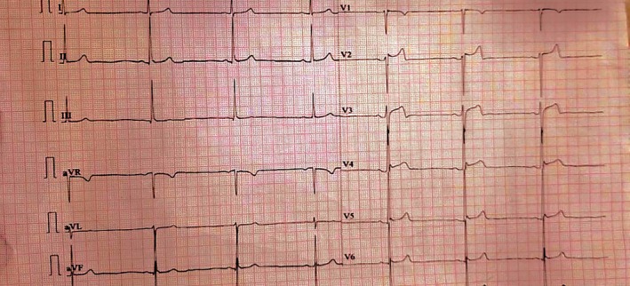 FIGURE 2