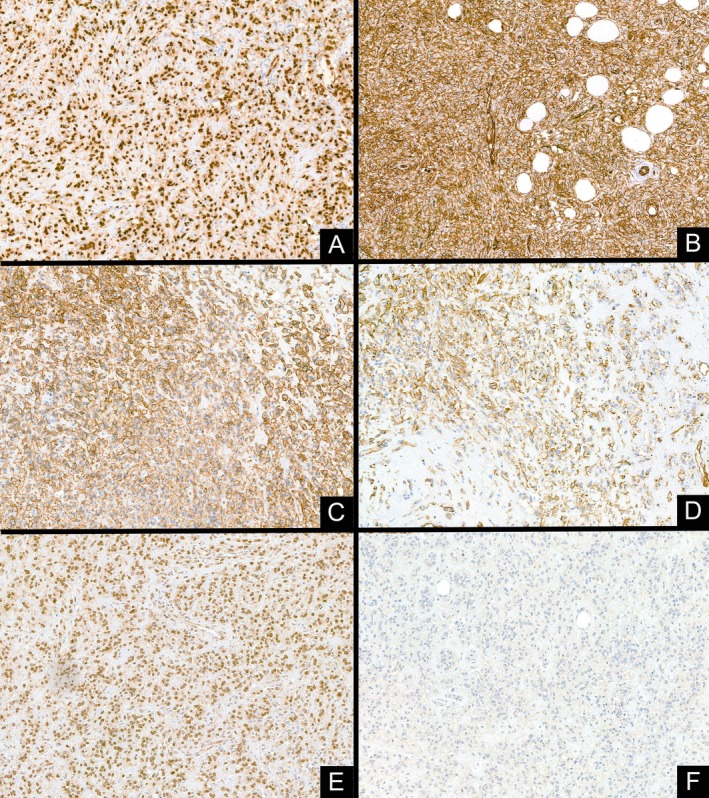 FIGURE 4