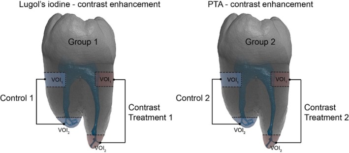 FIGURE 1