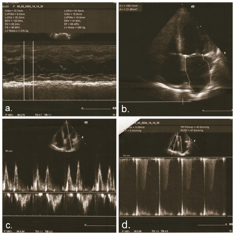 Figure 4