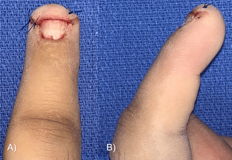 Figure 10