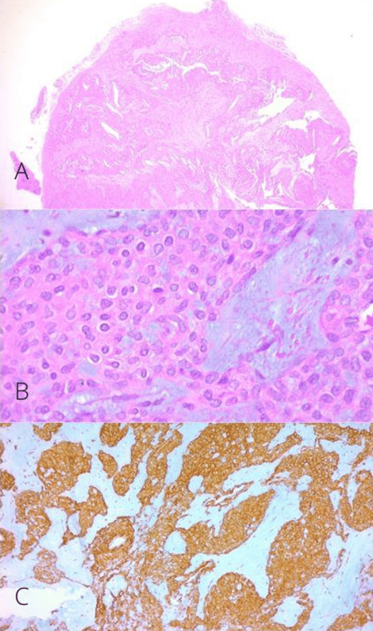 Figure 11