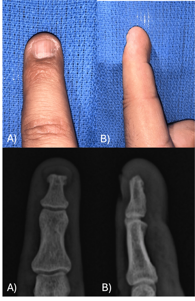 Figure 12