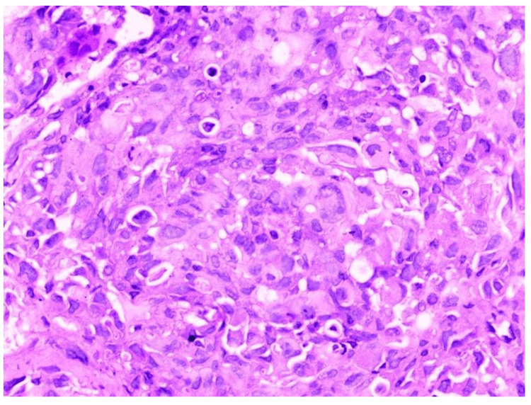 Figure 10