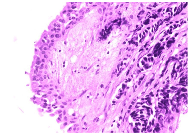 Figure 11