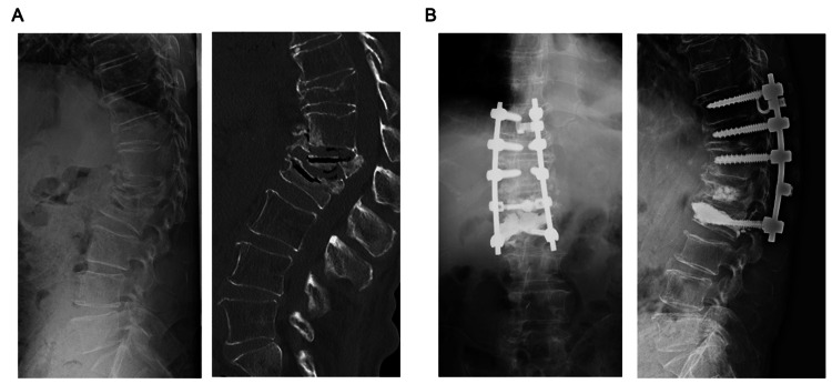 Figure 6