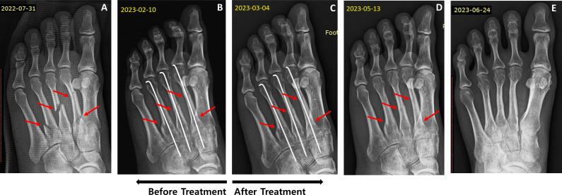 Figure 2
