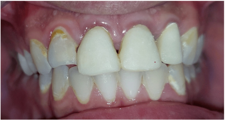 Figure 7