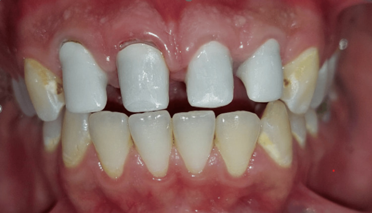 Figure 12