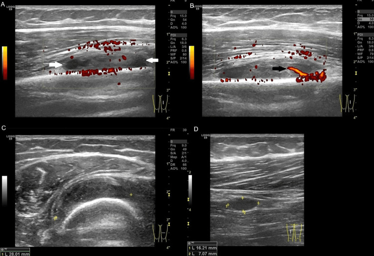 Figure 11