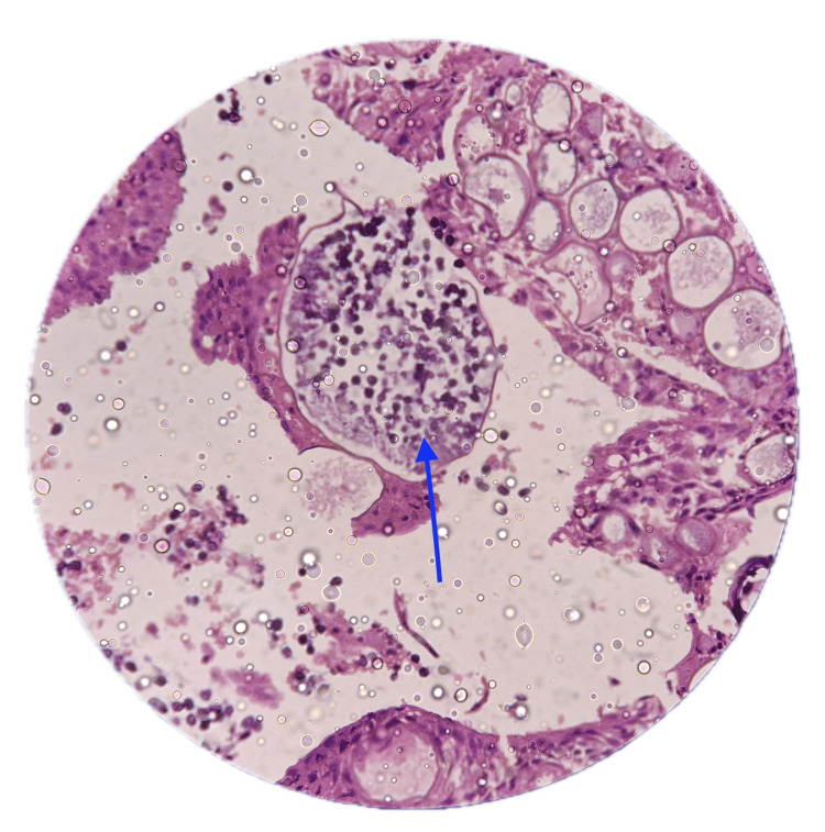 Figure 5