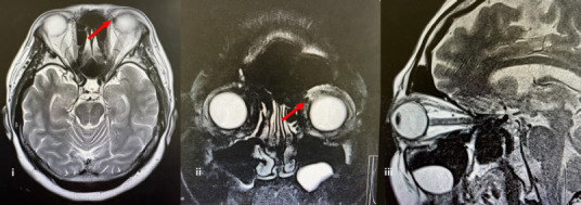 Figure 1B